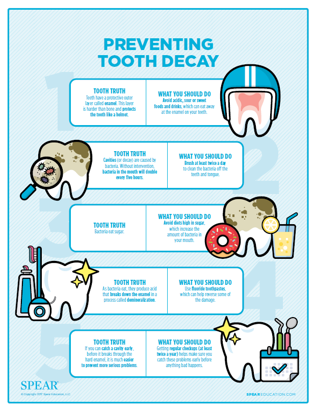 10+ Arrested Dental Caries Secrets To Stop Tooth Decay