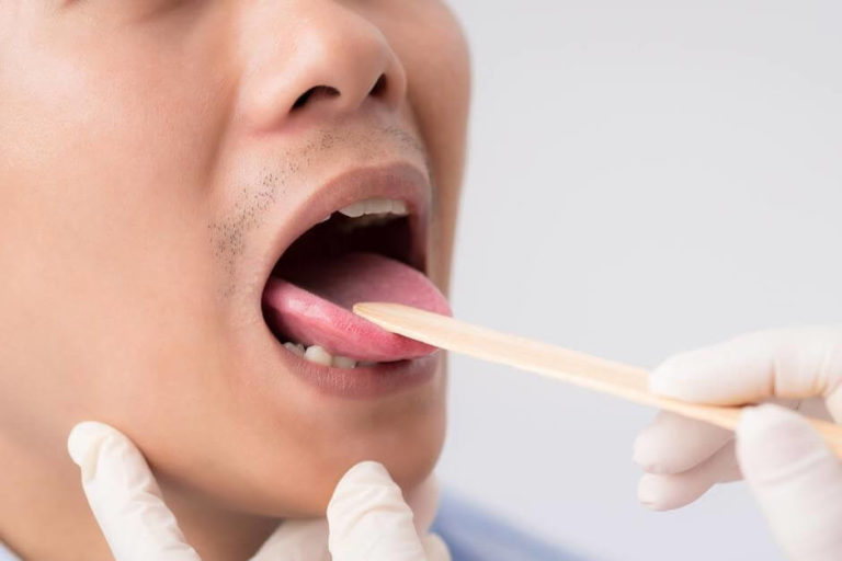 10+ Boutons Sur La Langue Treatments To Speak Clearly