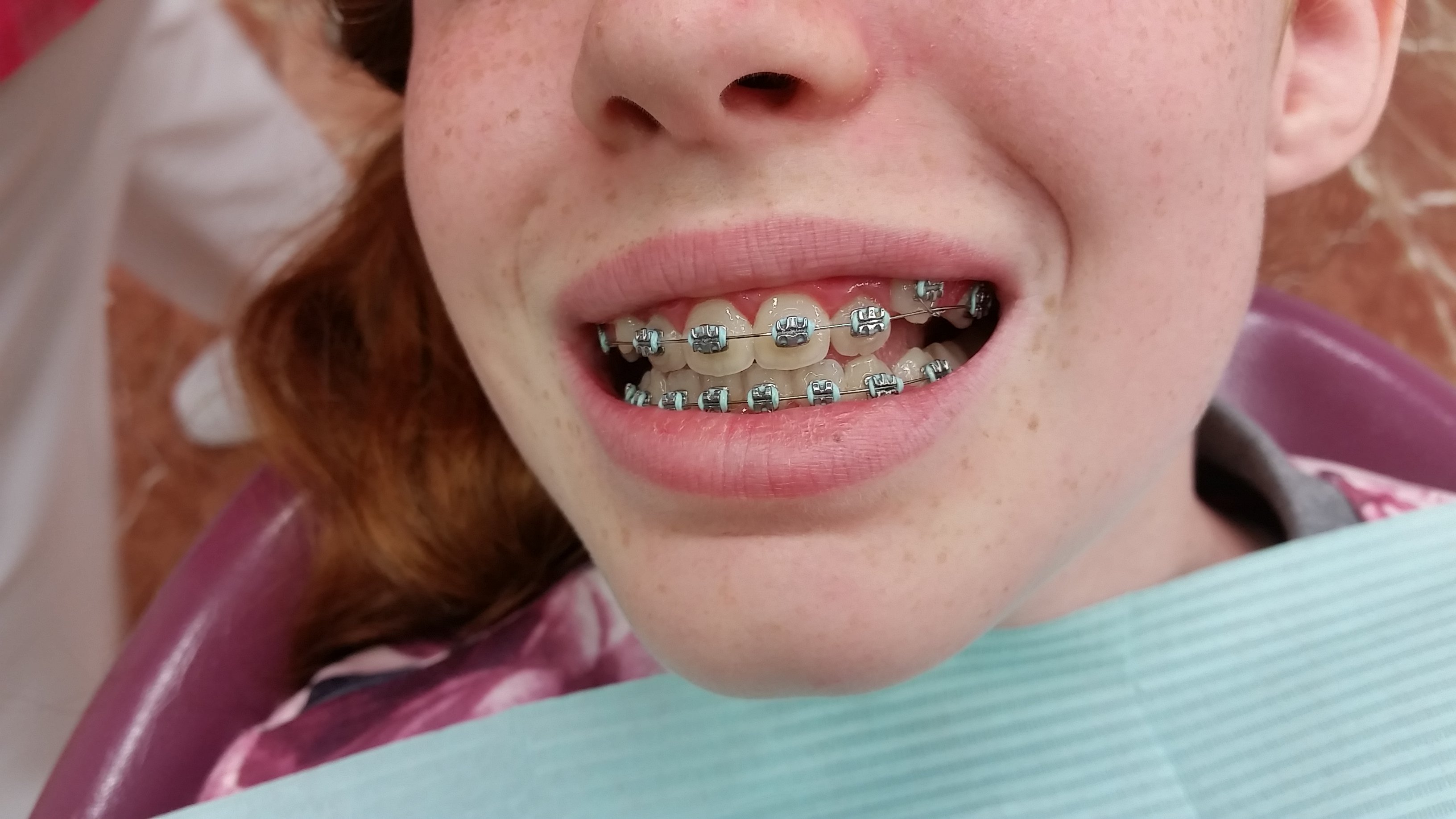 10+ Colores De Brackets Que Aumentan La Legibilidad 10+ Colores De Brackets Que Aumentan La Legibilidad