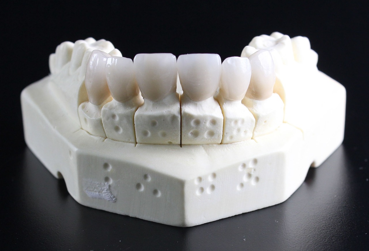10 Dmd Meaning Tips For Dental Success