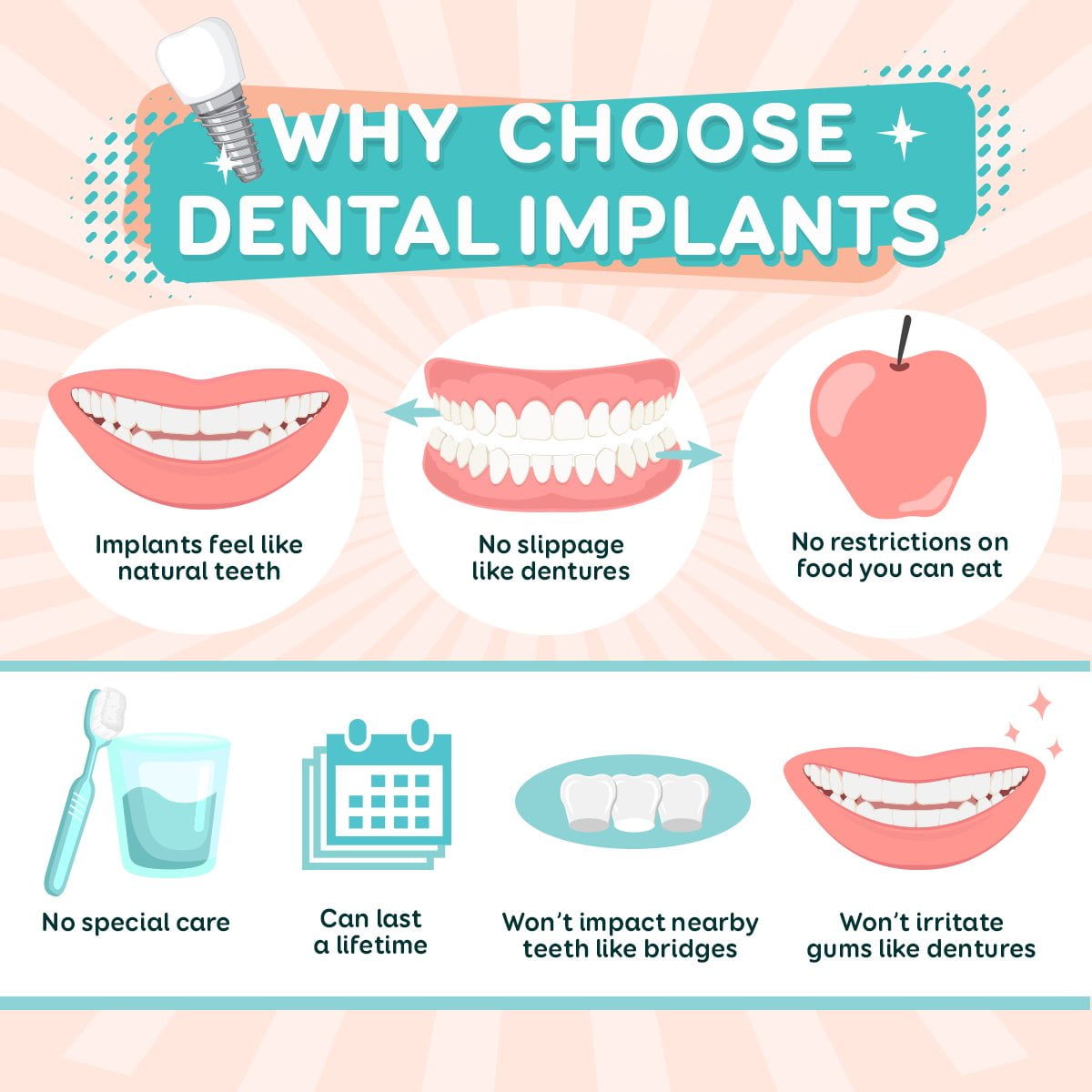 10 Full Fixed Arch Dental Implant Benefits 10 Full Fixed Arch Dental Implant Benefits