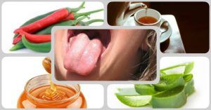 10 Sapitos En La Lengua Remedios Naturales