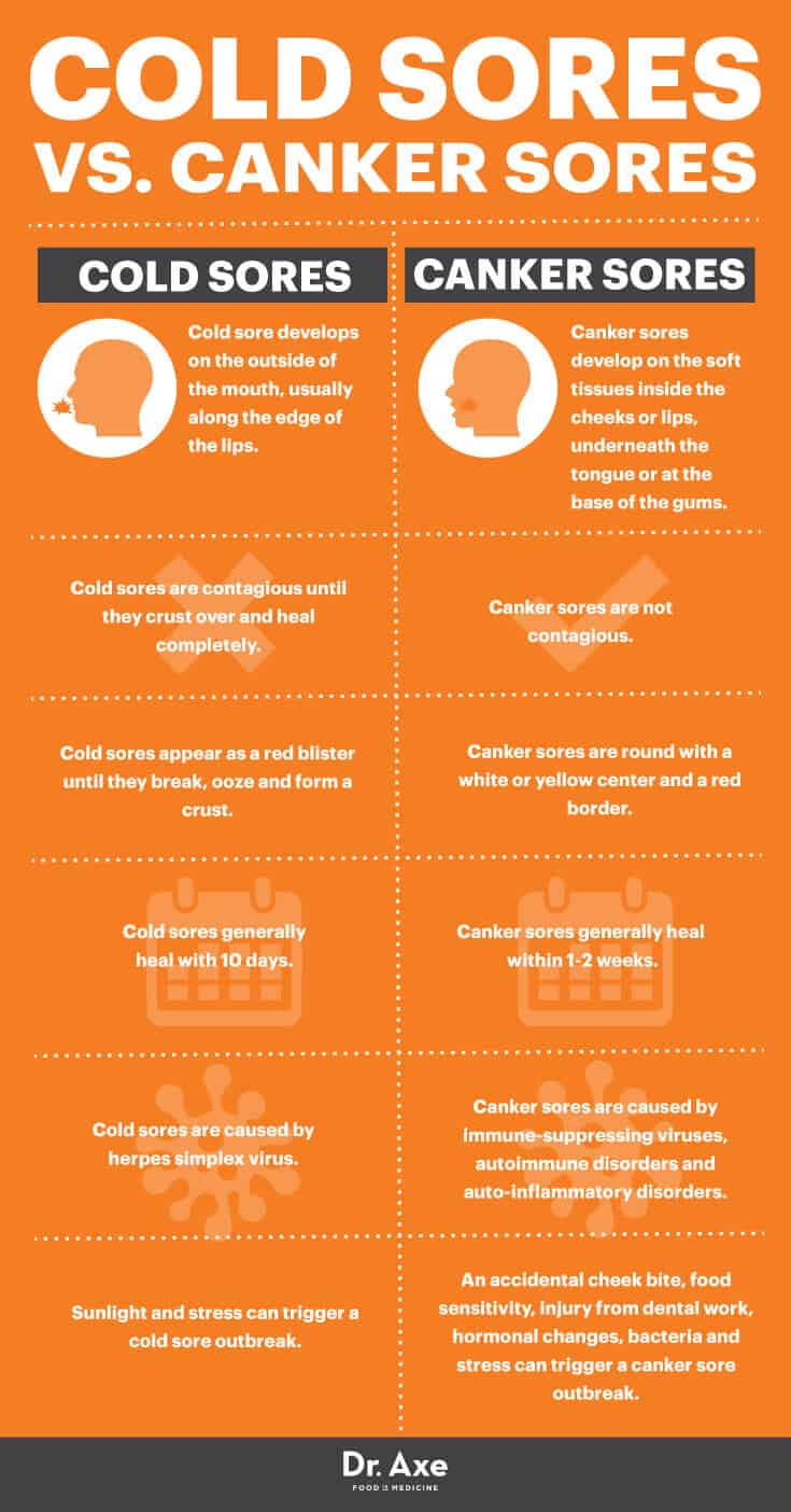 10 Sore Mouth After Surgery Remedies For Faster Healing 10 Sore Mouth After Surgery Remedies For Faster Healing