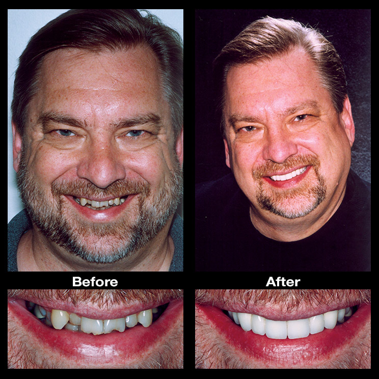 10 Teeth Secrets To Fix Crooked Smiles