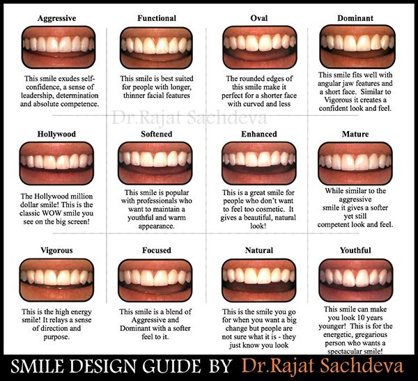 10 Tooth Shades Chart Tips For Perfect Smiles