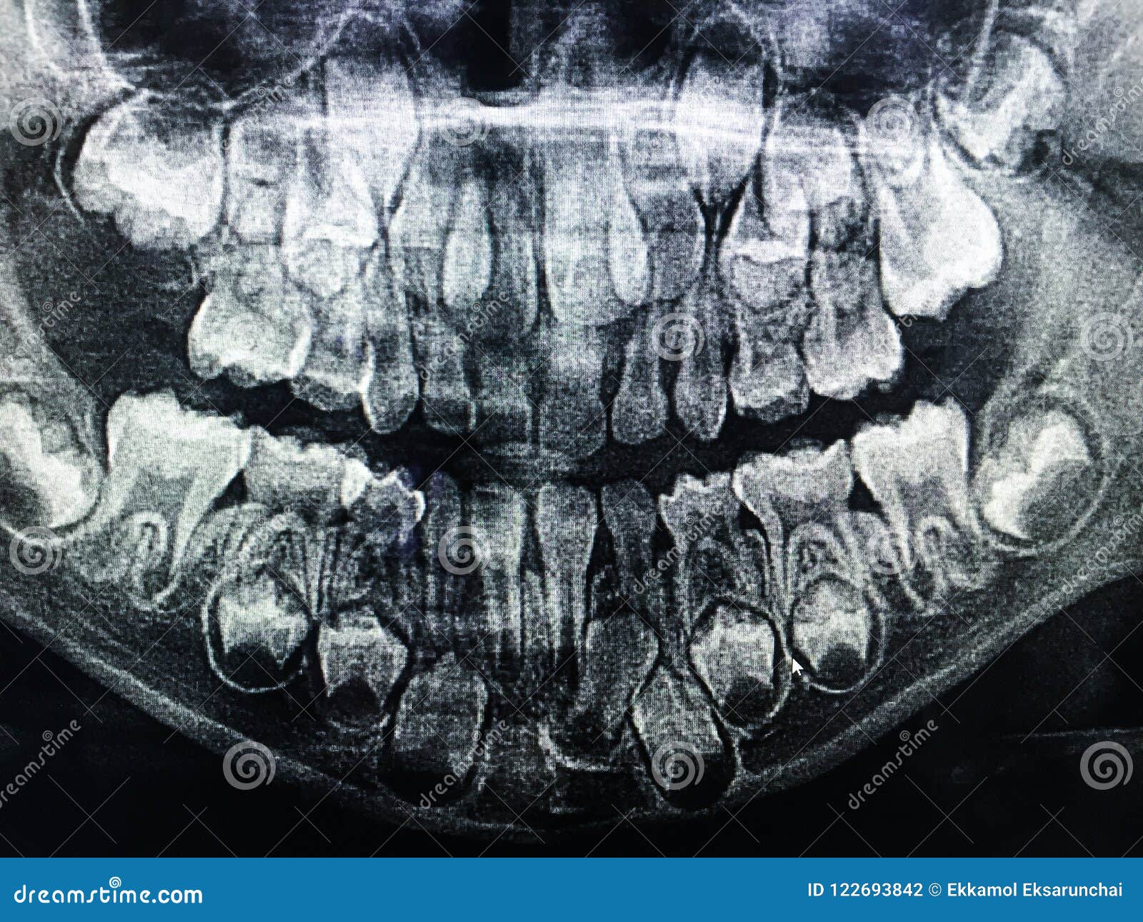 10 Xray Tips For Healthy Teeth