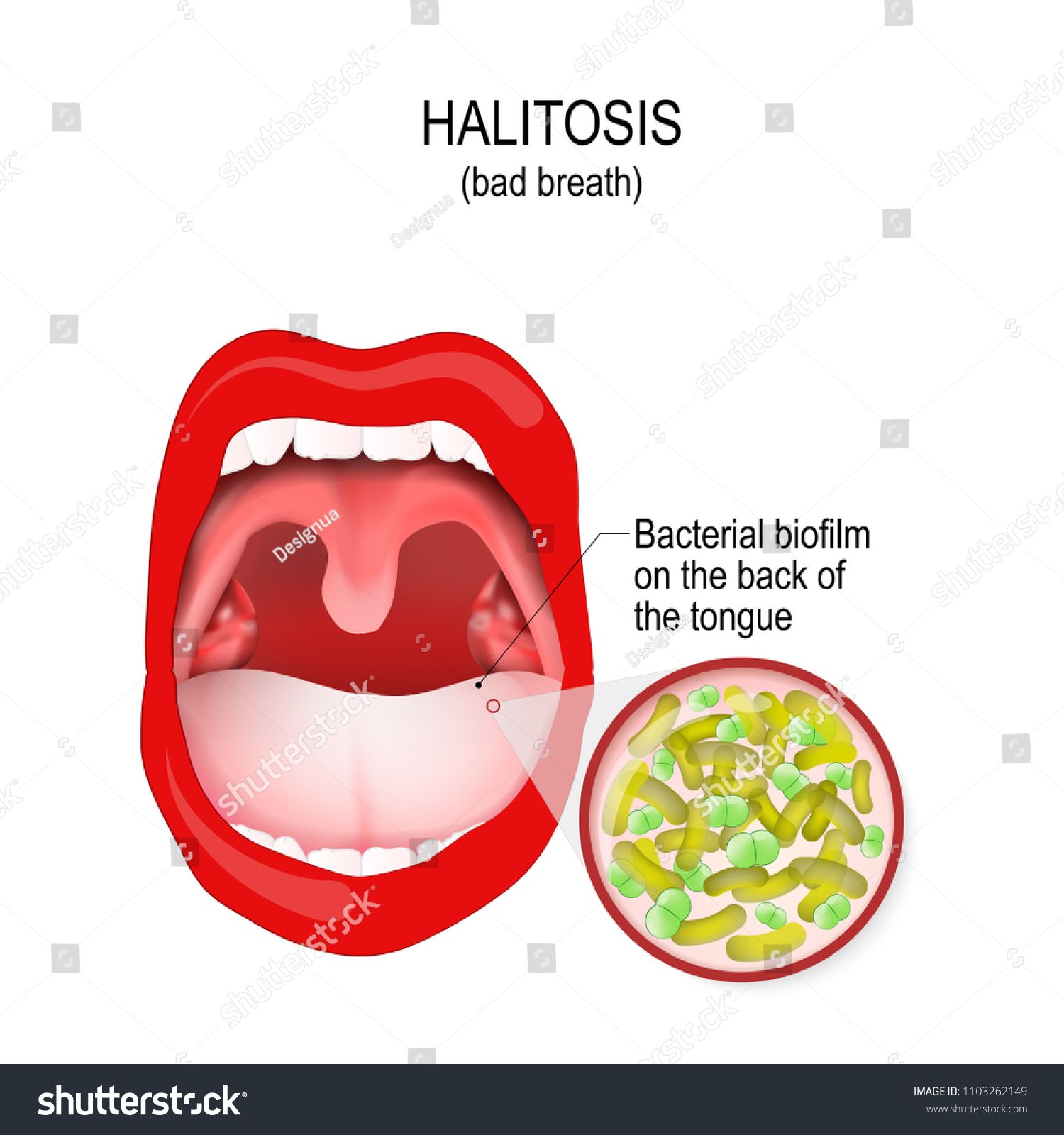12 Biofilm Mouth Hacks For Fresh Breath