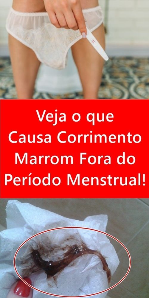12+ Causas De Corrimento Marrom Reveladas