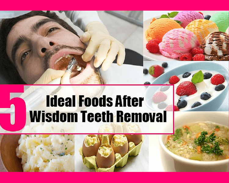 12+ Coffee Habits To Avoid After Tooth Removal