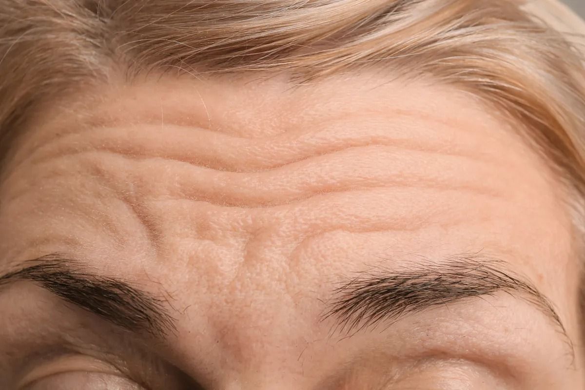 12+ Forehead Relief Tips