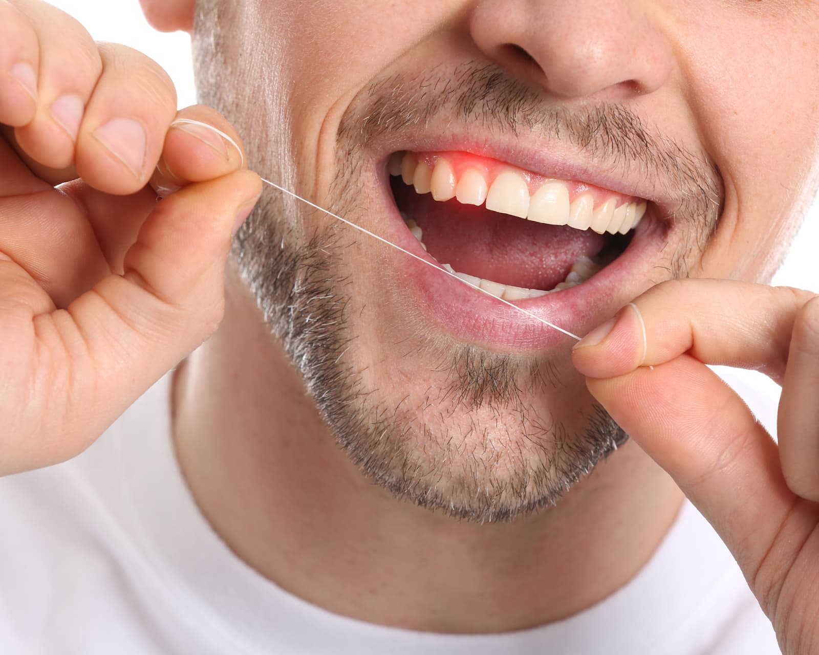 12+ Gum Cut Tips To Reduce Pain