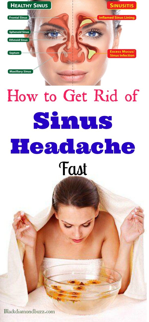 12 Headache Teeth Pain Remedies For Fast Relief