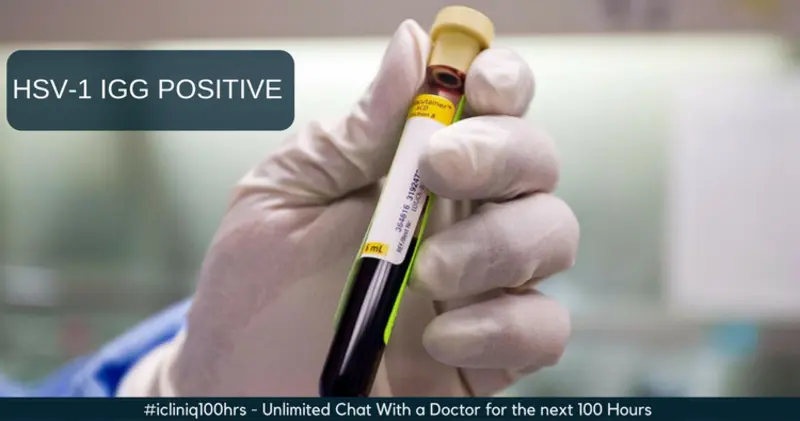 12+ Hsv Ii Igg Positive Tips To Reduce Symptoms