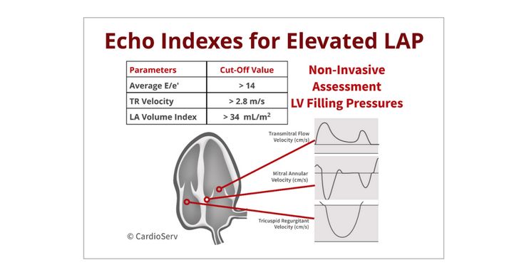 12 Left Atrial Pressure Ranges For Better Diagnosis