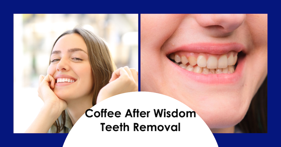 12+ Wisdom Teeth Coffee Hacks Guaranteed