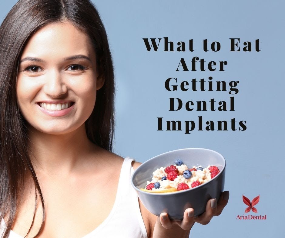 4 On 1 Implants
