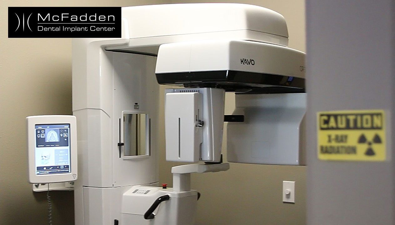 7 Dental Implant Secrets For Safe Scans