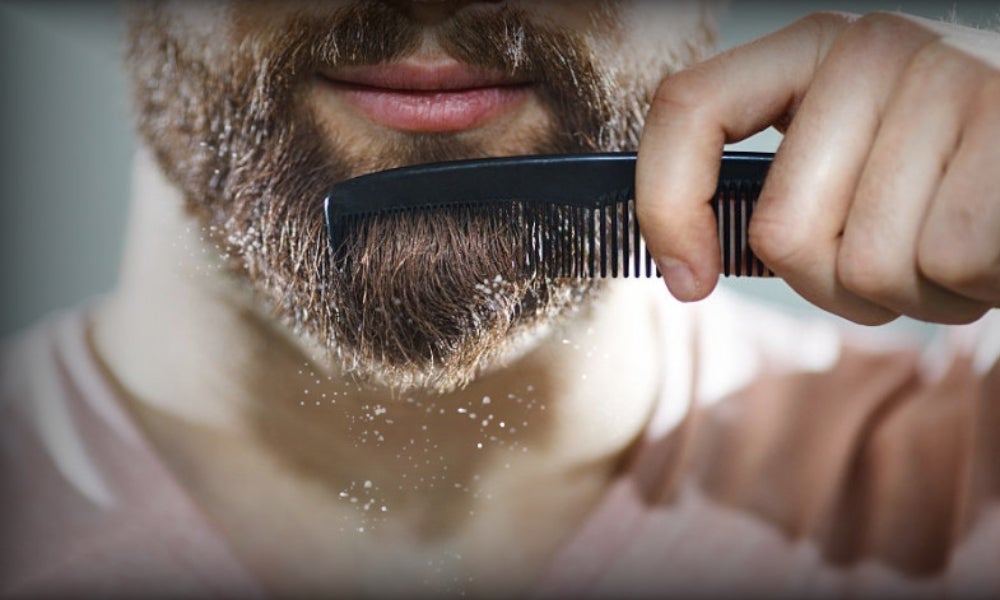8 Remedios Para La Caspa En La Barba Efectivos 8 Remedios Para La Caspa En La Barba Efectivos