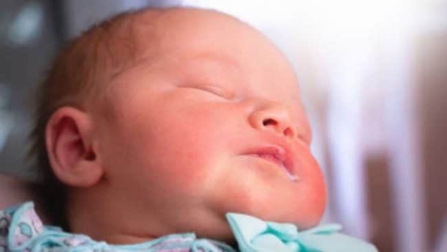 Algodoncillo En Bebes Como Curarlo