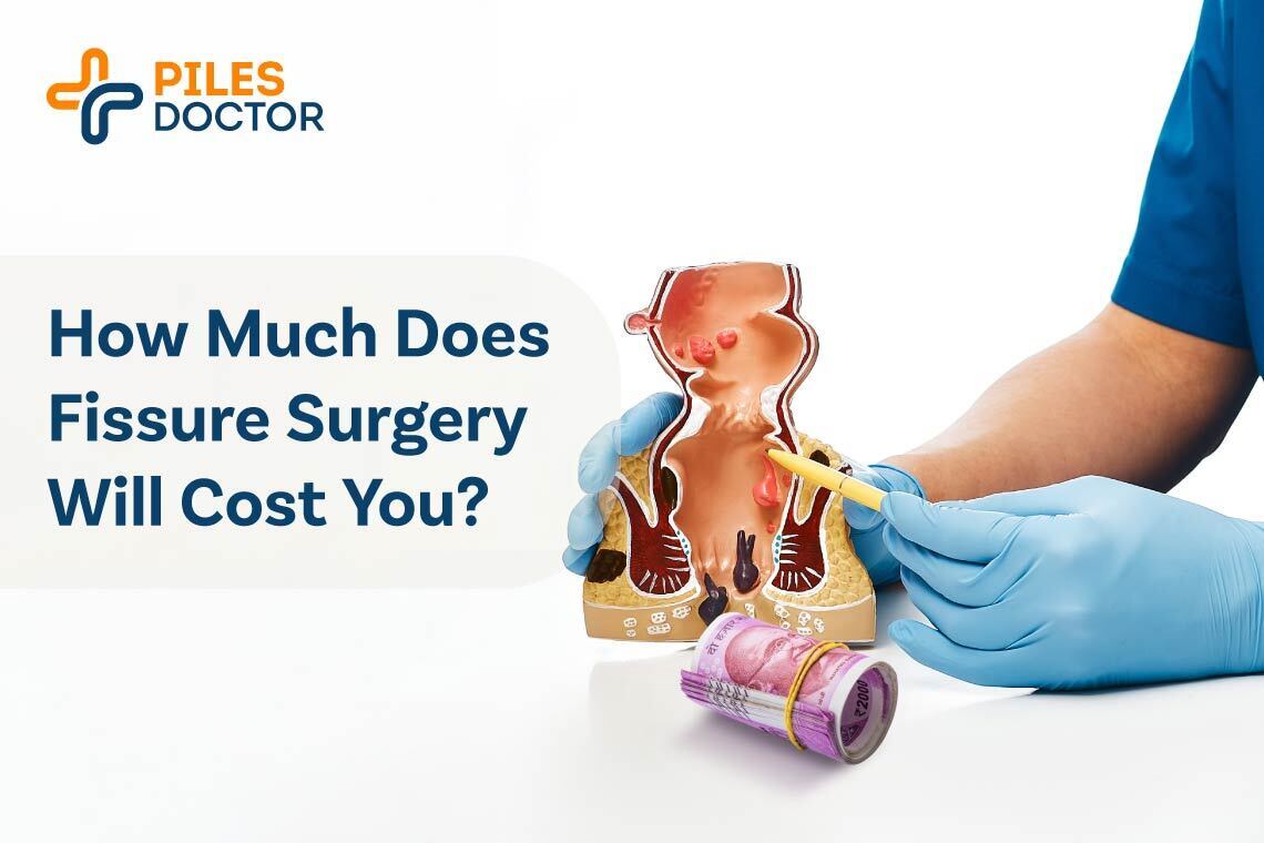 Anal Fissure Surgery Recovery