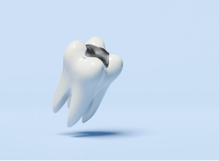 Black Lines On Molars Black Lines On Molars