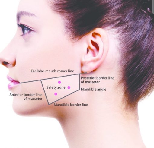 Botox For Clenching: Stop Teeth Grinding