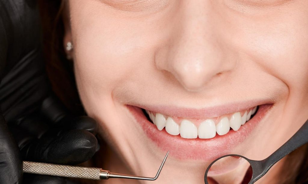 Bridge Front Teeth Guide: Gap Solution Made Easy
