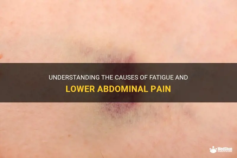 Bruising On Lower Back Pain