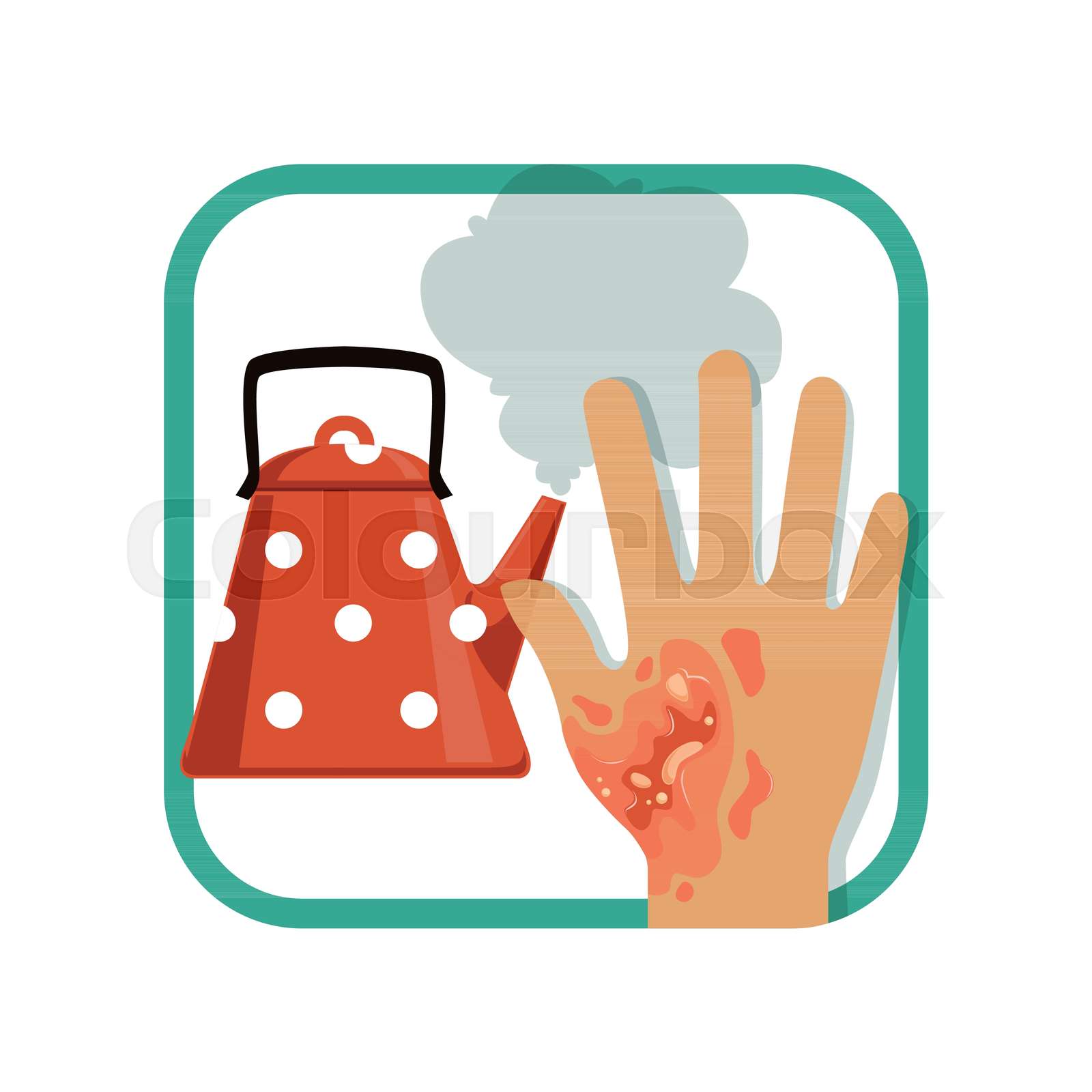Burn Injury Photos