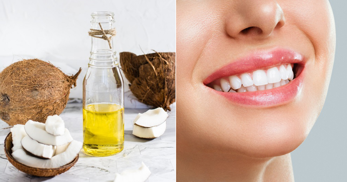Can Coconut Oil Whiten Teeth
