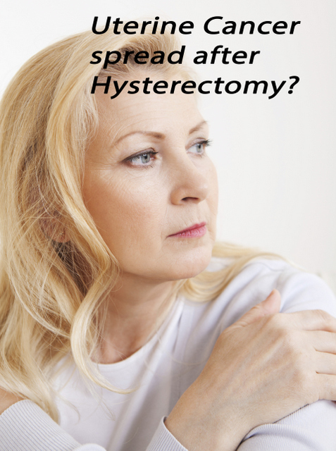 Can Hysterectomy Cause Cancer