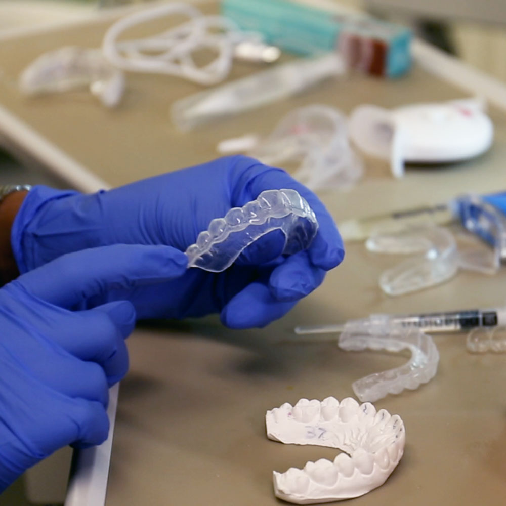 Carbamide Peroxide Teeth Whitening Explained Carbamide Peroxide Teeth Whitening Explained