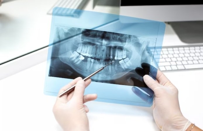 Childs Teeth Xray Guide