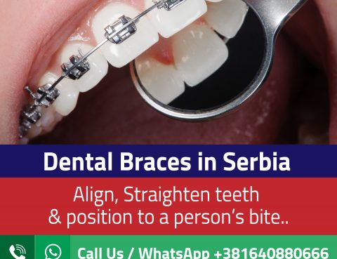 Cost Of Dental Braces