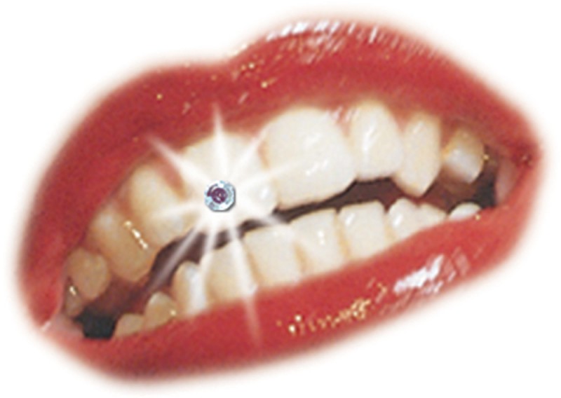 Crown Glue Tooth