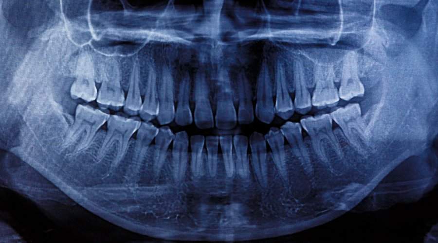 Cuantos Dientes Tienen Los Humanos