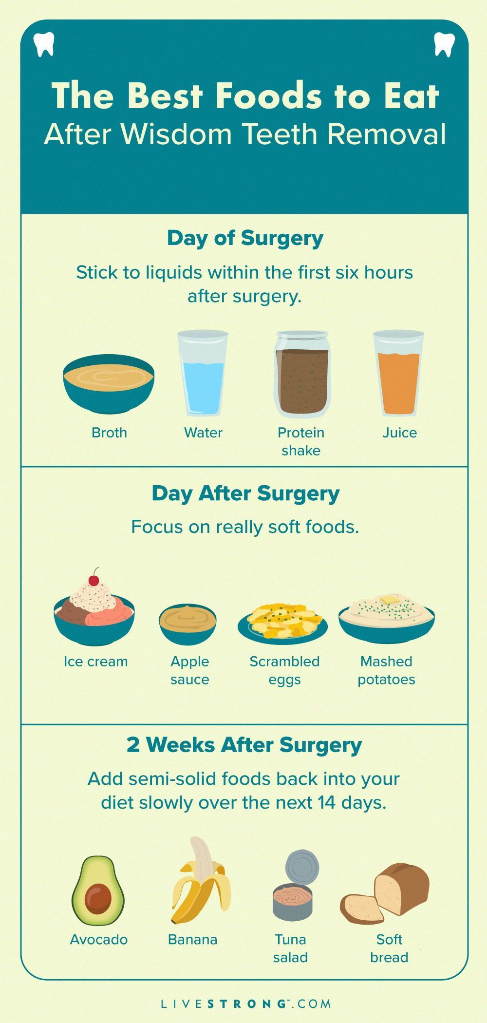 Day 6 Wisdom Teeth Removal