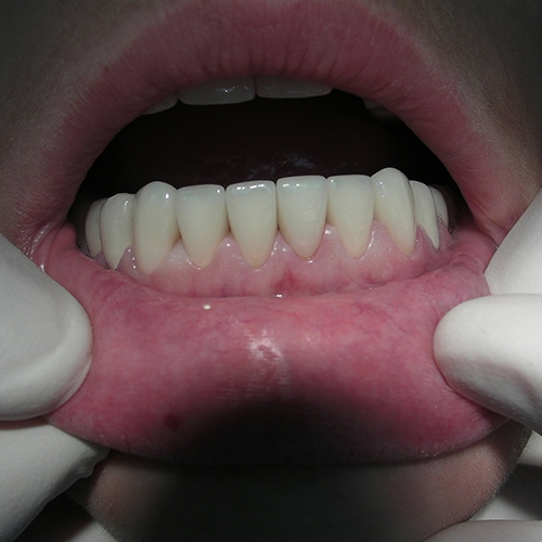 Dental Bridge Services Near Me Dental Bridge Services Near Me