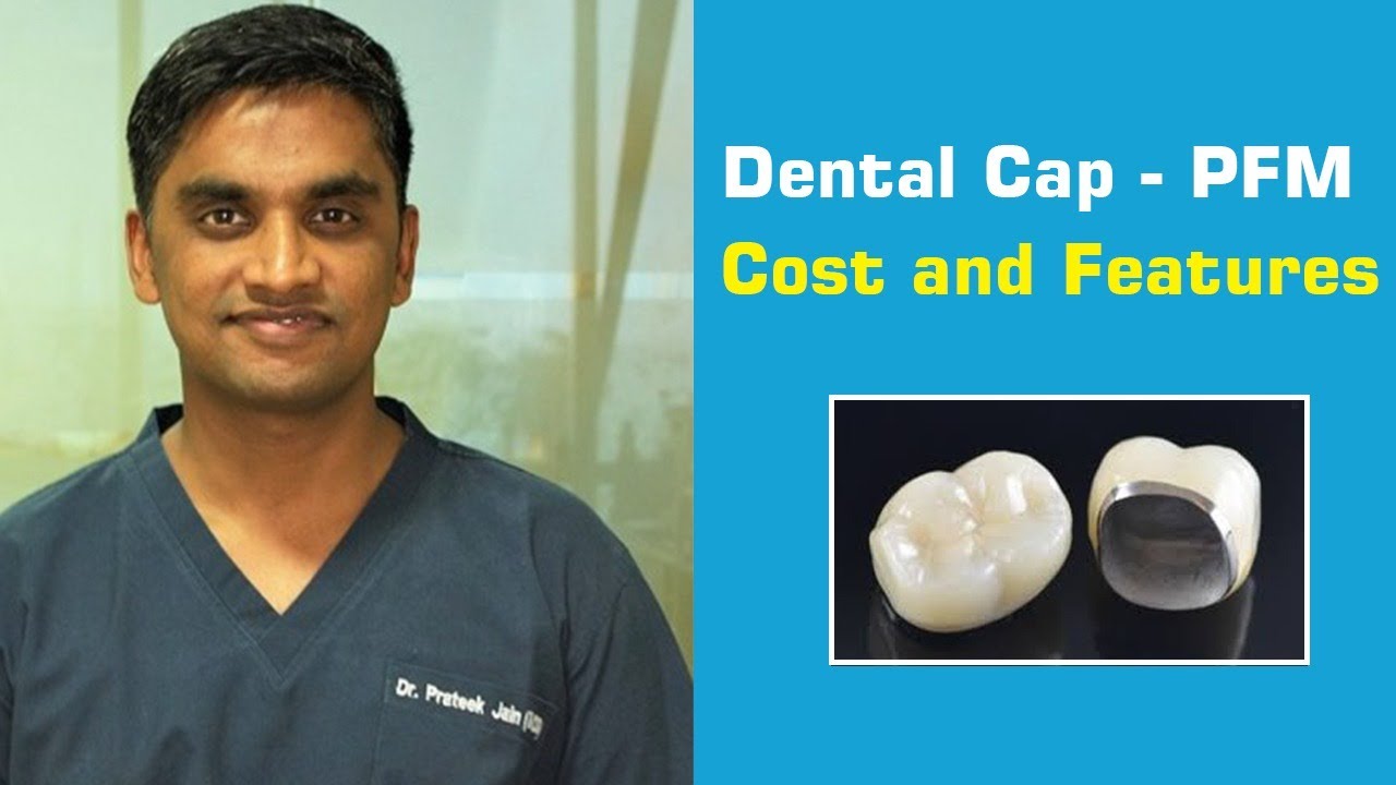 Dental Cap Cost