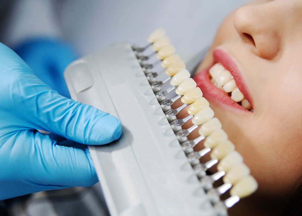 Dental Crowns & Bridges
