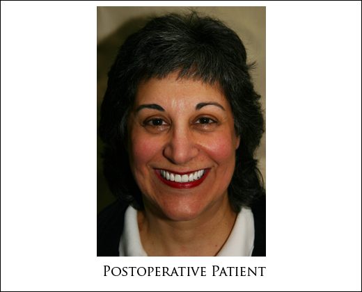 Dental Partial Repair Guide: Restore Smile Today Dental Partial Repair Guide: Restore Smile Today