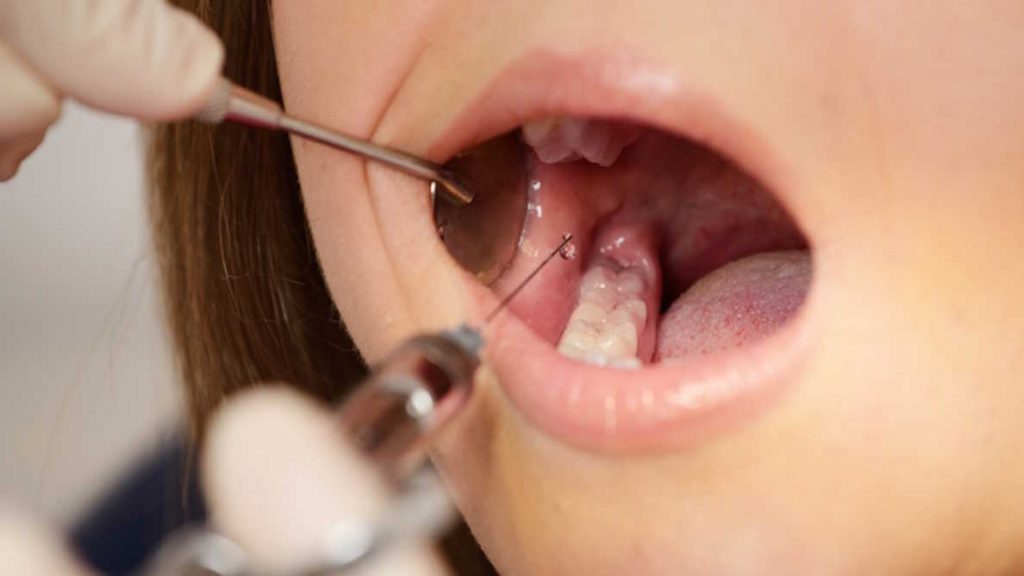 Dentist Anesthesia Risks Revealed