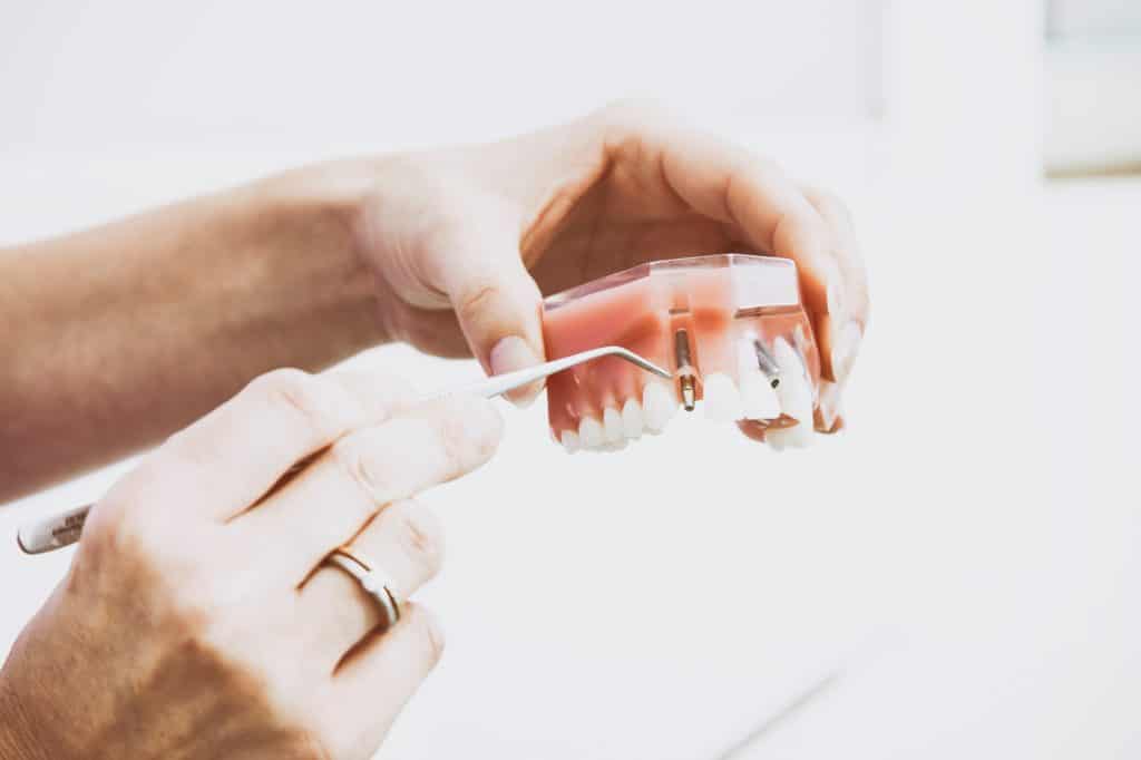 Denture Care Guide: Expert Solutions Nearby