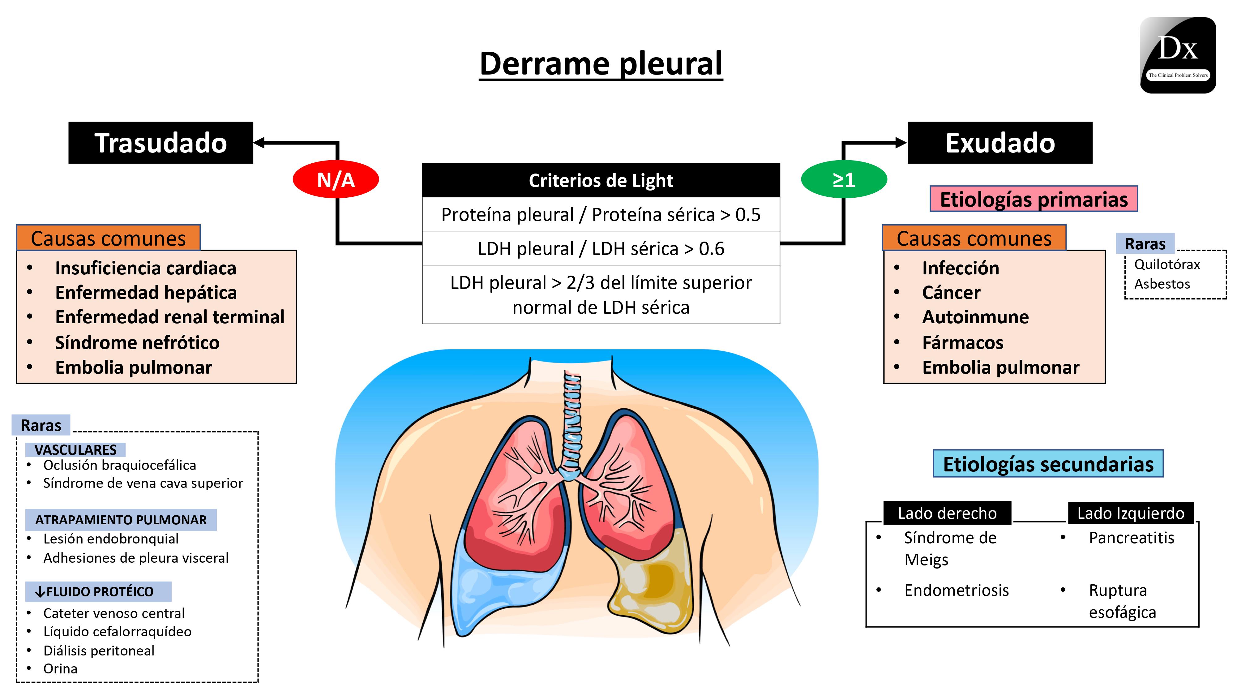 Derrame De Pleura Sintomas