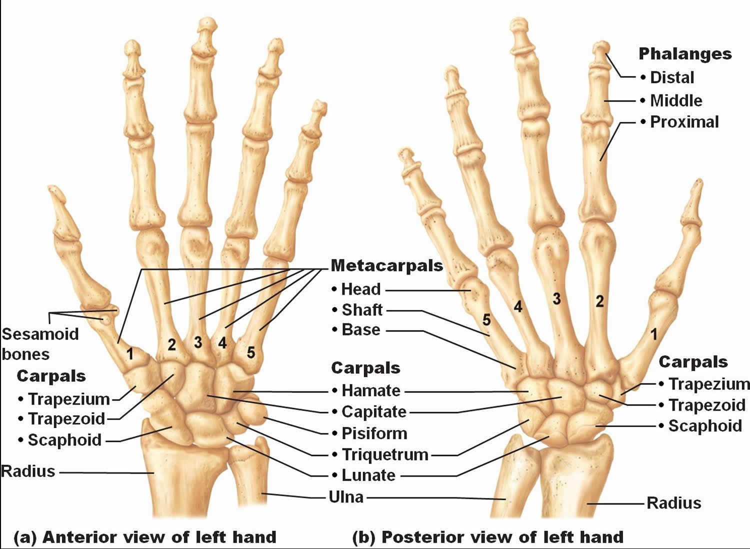Dislocation Of Hand Bones