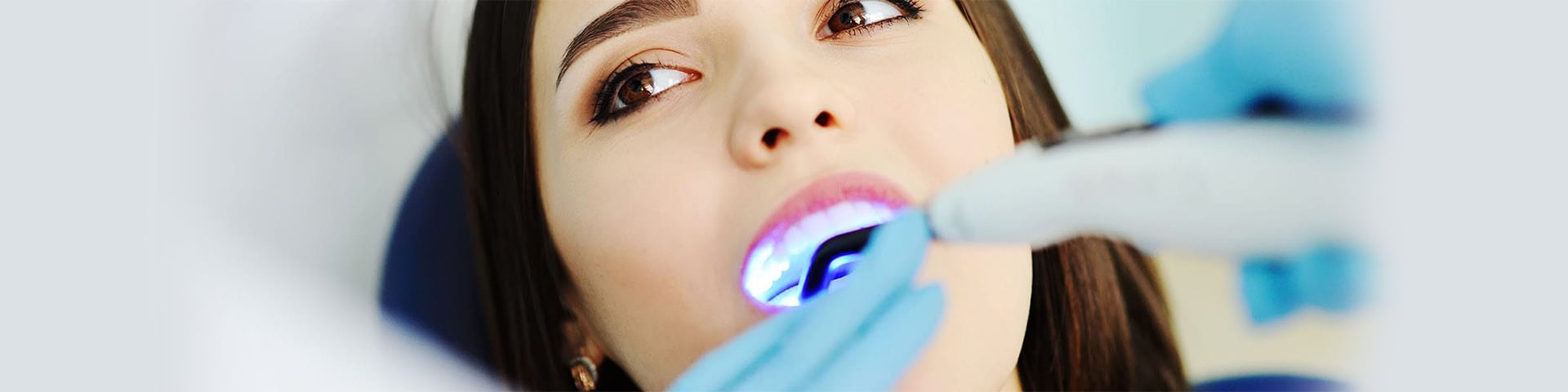 Do Teeth Fillings Last Forever