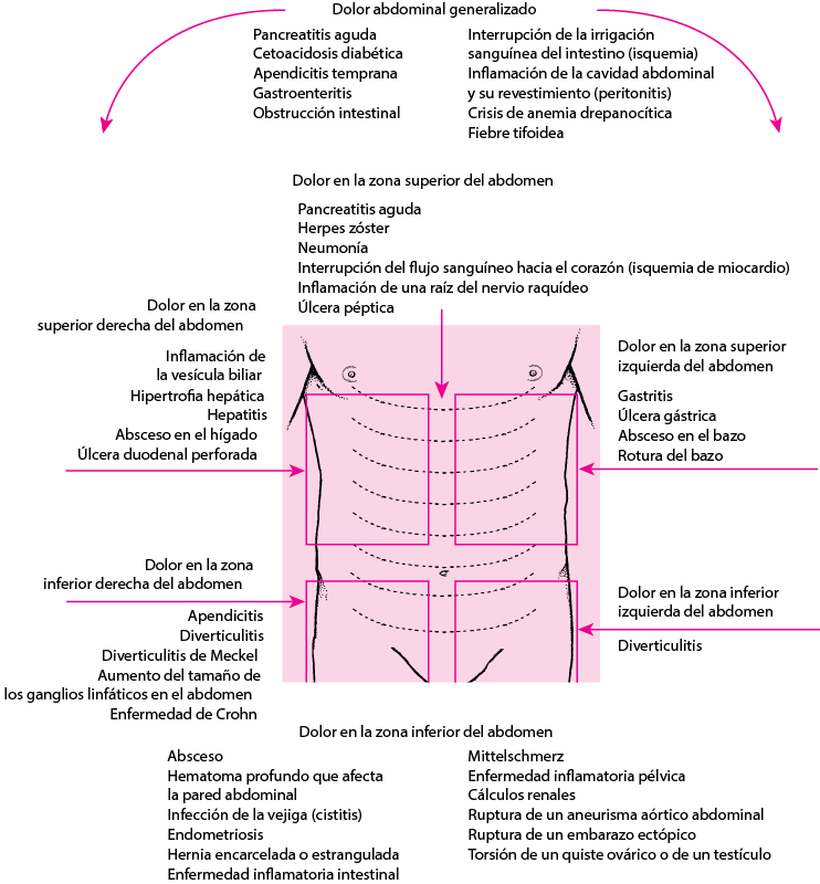 Dolor Abdominal: Diagnóstico Y Tratamiento Completo