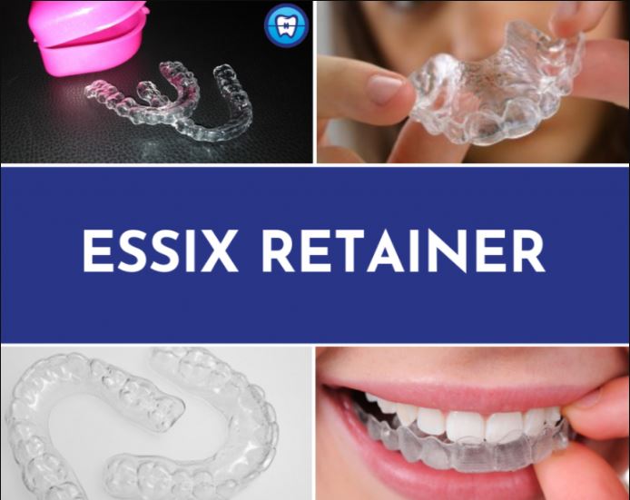 Essix Clear Orthodontic Retainer