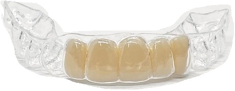 Essix Dental Retainer: Perfect Smile Guarantee