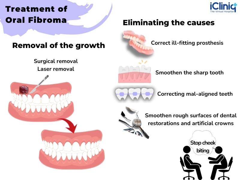 Fibroma Of The Tongue: Effective Treatment Options Available